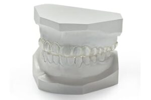 Flexiguard | Nightguard | DDS Dental Lab